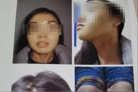 对话5年5次起诉离婚当事女子：第一次起诉后他暴力行为升级图片