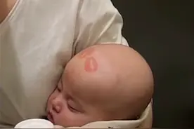 太可爱了！4个月萌娃光头上被妈妈的闺蜜亲了好几个唇印 醒来一脸懵图片