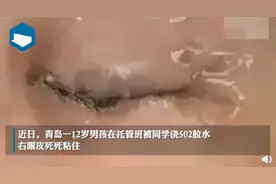 青岛12岁男孩被托管班同学浇502胶水，右眼皮死死粘住！网友怒了图片