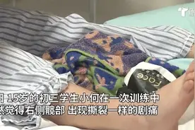 没摔也没撞，15岁初中生跑步时离奇骨折图片