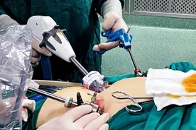 一年10000例！“切胃减肥”被滥用还是切得不够？图片