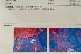 29岁男子连喝8天白酒，一查竟患10多种疾病，医生下达病危通知图片