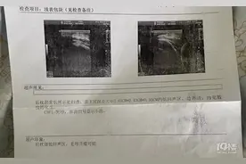 孩子脖子后有颗粒状物，医院一查，竟是肿瘤图片