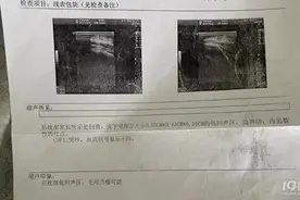 孩子脖子后有颗粒状物，医院一查，竟是肿瘤图片