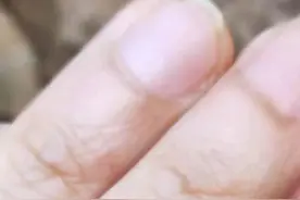四川首现！比米粒还小的蜘蛛……图片