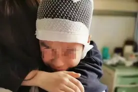 老师揪学生头发致皮骨分离被刑拘！孩子经历7次穿刺，出血量1000毫升图片
