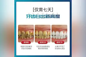 Qing调查｜“7天就能黄牙变白牙”网红美白牙贴靠不靠谱？图片