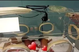 9胞胎！非洲妈妈一胎生下5女4子 目前母婴平安(图)图片