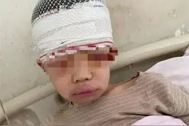 9岁男孩被老师薅头发致头皮头骨分离！还想“私了”？图片