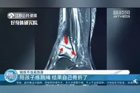 妈妈陪孩子练跳绳后，小腿疼了两个多星期，到医院一查“傻眼”了图片