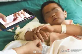 最新进展——接臂手术第五天，小男孩伤臂渐渐消肿图片