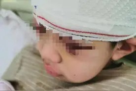 9岁男孩遭老师猛拽致头皮头骨分离 涉事教师被刑拘曾想“私了”家长：绝不原谅图片