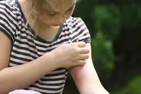 夏天到，蚊子叫！夏季如何科学防蚊？视频封面