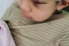 平顶山一教师“体罚9岁男童致皮骨分离”被刑拘，区纪委介入调查图片