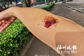 行道树上结的“葡萄”能吃吗？园林专家：不建议食用图片