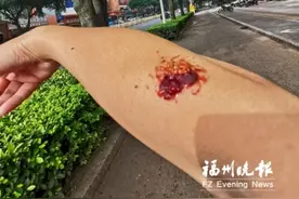福州：行道树上结的“葡萄”能吃吗？园林专家：不建议食用图片