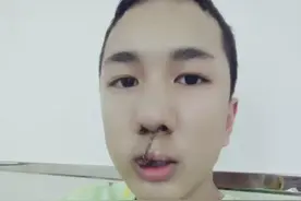 韩美娟晒唇腭裂时期照片支援“世界微笑日”图片