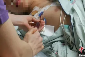 广东省脐血库脐血出库应用例数达2900例图片