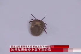 警惕！辽宁一2岁男孩后脑勺被咬！取出来还活着图片