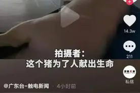医生杀猪为烧伤男子植皮？医生：老技术了图片