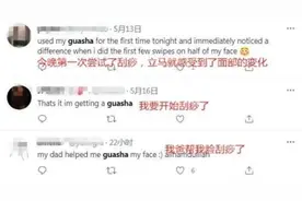 刮痧美容在海外火起来 老外被这“神秘的东方力量”折服图片