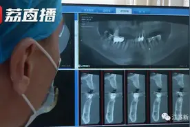 吃饭磕掉一颗牙，女子怒告饭店：糖醋排骨里有骨头！法院这么判…图片