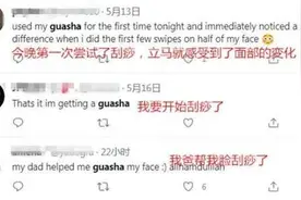 刮痧美容火到海外 老外们被这“神秘的东方力量”折服图片