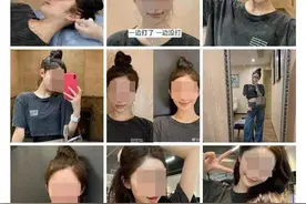耳朵太小显脸大？还有人到整容医院整出来“精灵耳”图片