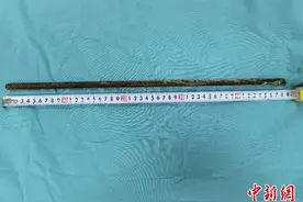 钢筋穿透建筑工人头颈 湖南一医院上演紧急救援图片