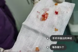 女孩为瘦切断小腿神经，别把“自残”误认为美｜沸腾图片