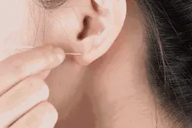 女大学生下肢疼痛3个月差点瘫痪，“元凶”竟是打耳洞图片