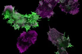 研究发现调控细胞迁移和巨胞饮作用的新分子图片