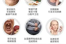 缺牙老人保健五宜图片
