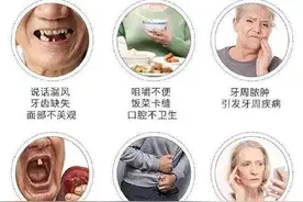 缺牙老人保健五宜图片