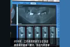 一分不赔！女子吃排骨磕掉牙索赔被法院驳回图片