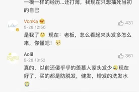 脱发经济“秃然”崛起，“头顶消费”几近刚需图片