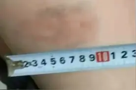体育老师打伤全班54名学生，家长：下手太狠了图片