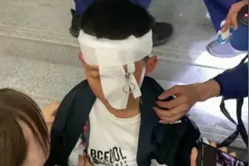 心疼又好笑！男孩被拉链夹住眼皮大哭 消防员解救后调侃安慰“夹出双眼皮了”图片