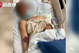 男子钓鱼回家后发烧又咳血，一查竟感染可怕病毒！警惕图片