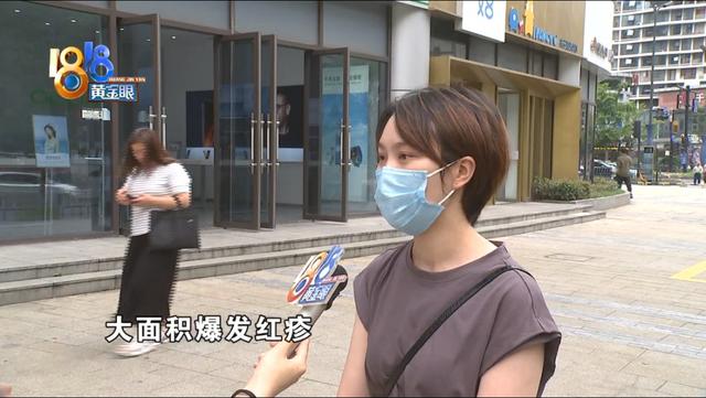 全身皮肤起鸡皮红疹