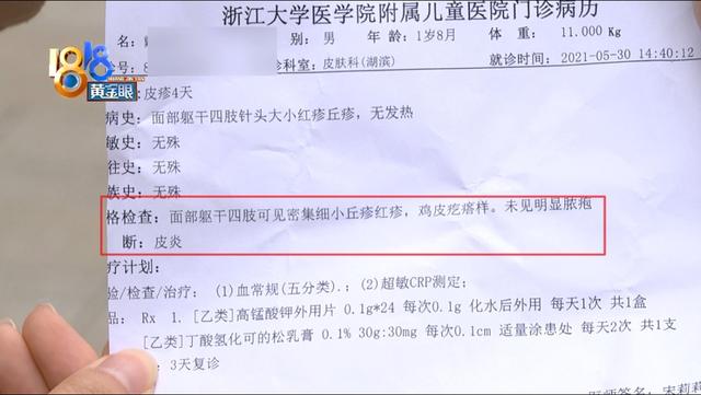 全身皮肤起鸡皮红疹