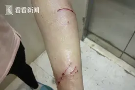 母女遛狗被猫抓伤“猫主人”主动赔偿却又反悔？图片