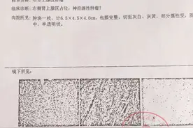 患者花5万切瘤后不理赔，太平洋保险：良性肿瘤不在保障范围图片