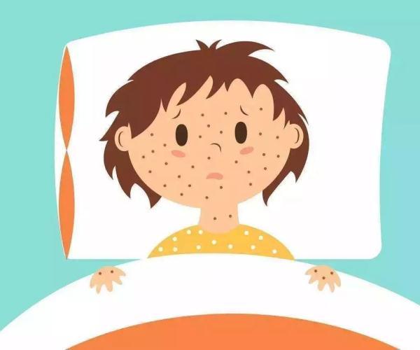 长水痘要怎么办