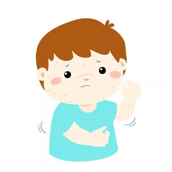 健康｜“水痘”的防治知识