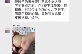 嫌婴儿车挡道，大妈居然掐下4个月婴儿脚皮……警方：拘留图片