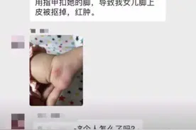 嫌婴儿车挡道，大妈居然掐下4个月婴儿脚皮……警方：拘留图片