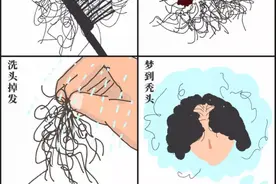 00后加入脱发大军！越撸铁越头秃？腿毛也能拿来植发？你关心的问题有回答了图片