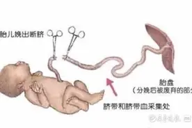 关于脐带血的那些事，读懂这篇就够了图片