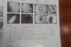说好免费检查 同方医院咋直接动手术了？图片